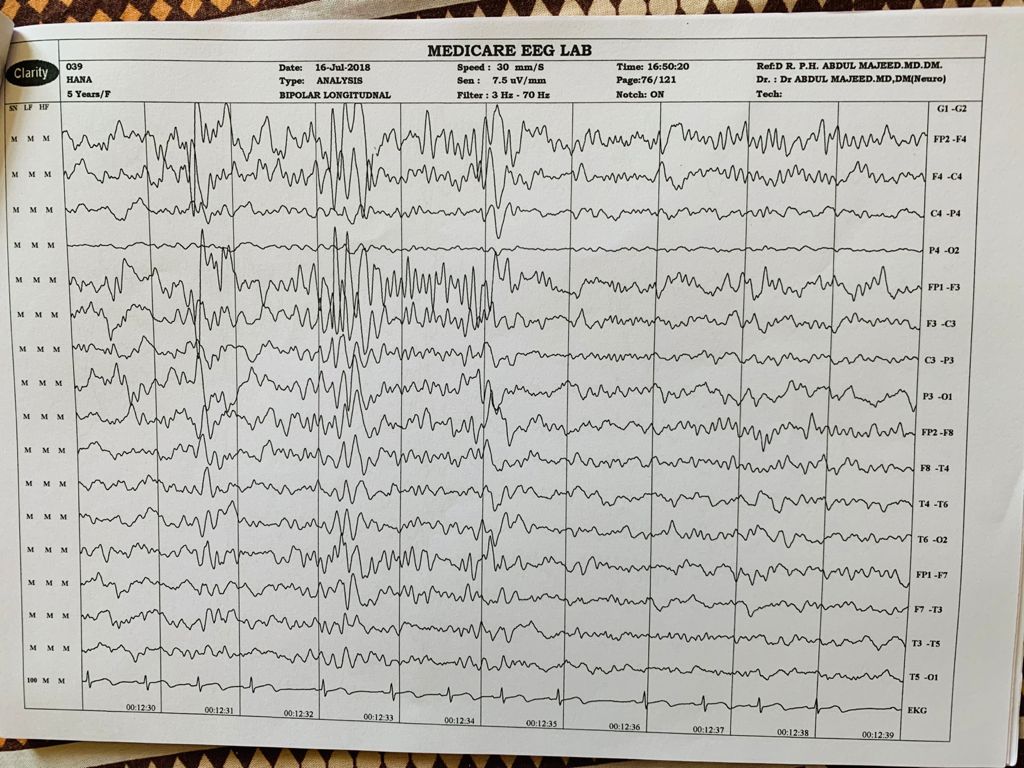 Patient Story